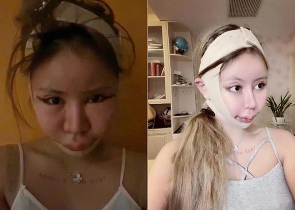 Lạ đời chuyện các nàng hậu nhí phải phẫu thuật thẩm mỹ khi còn chưa đủ tuổi - 12
