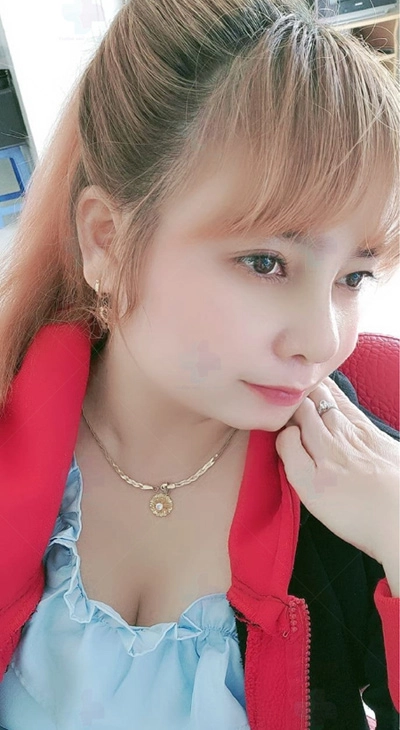 Làm đẹp nhẹ nhàng với nâng mũi nano fast plus - 3