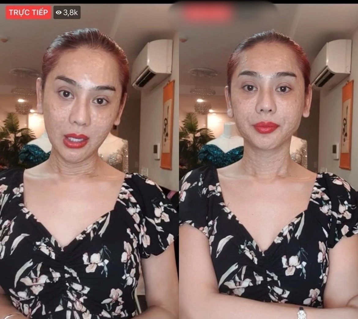 Lâm khánh chi thừa nhận nợ nần vì chuyển giới nhan sắc từng trồi sụt thất thường - 10