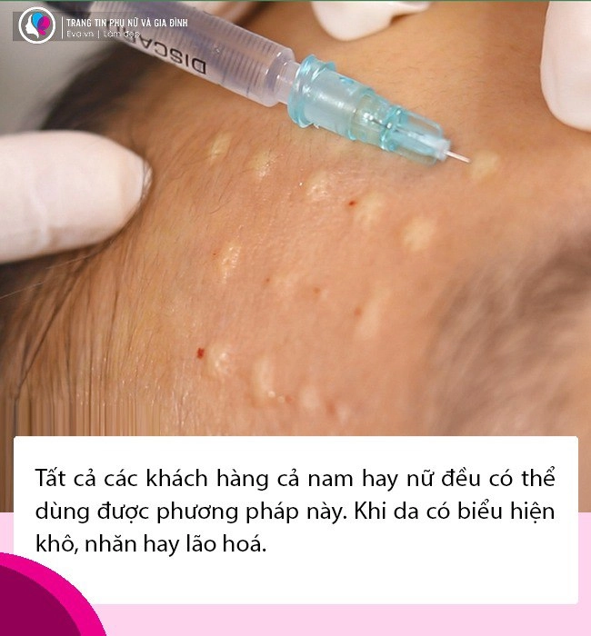 Lâm khánh chi thừa nhận nợ nần vì chuyển giới nhan sắc từng trồi sụt thất thường - 12
