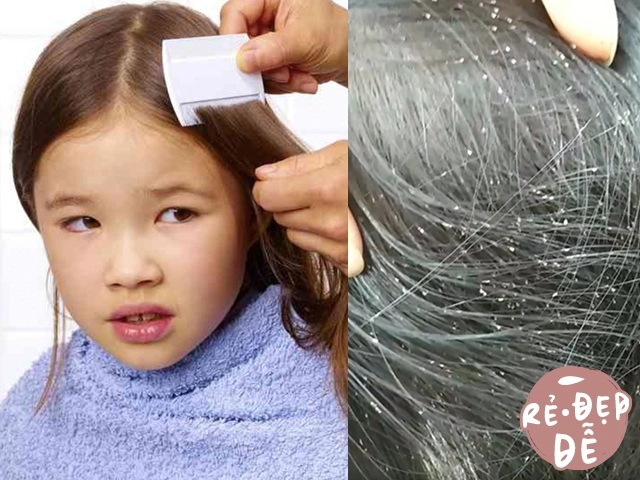 Làm phù dâu đám cưới anh trai harper beckham bị dân tình chê lớn vỡ hết nét - 16