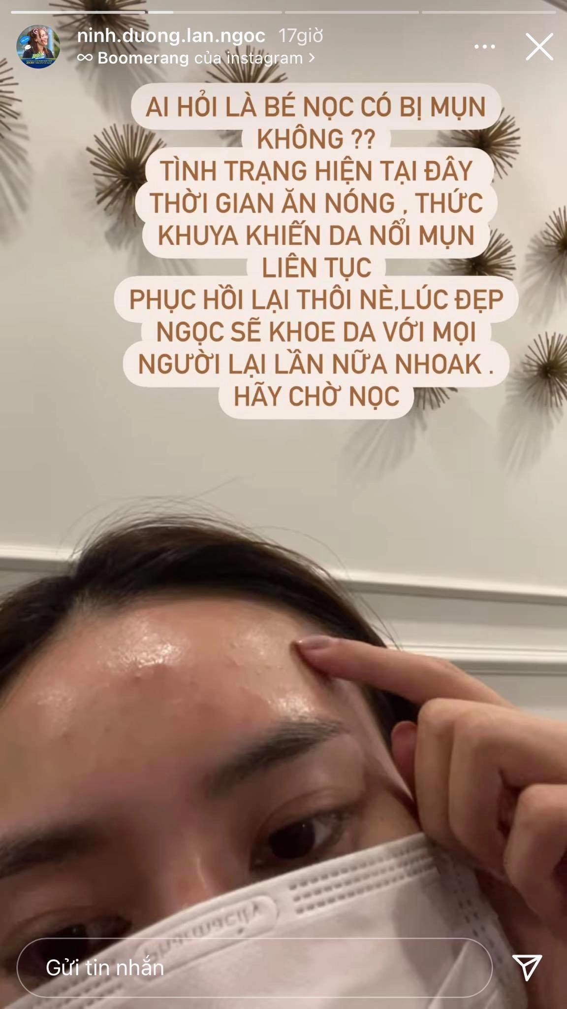 Lan ngọc tụt hạng danh xưng ngọc nữ vì làn da chi chít mụn nhìn mà thương - 1