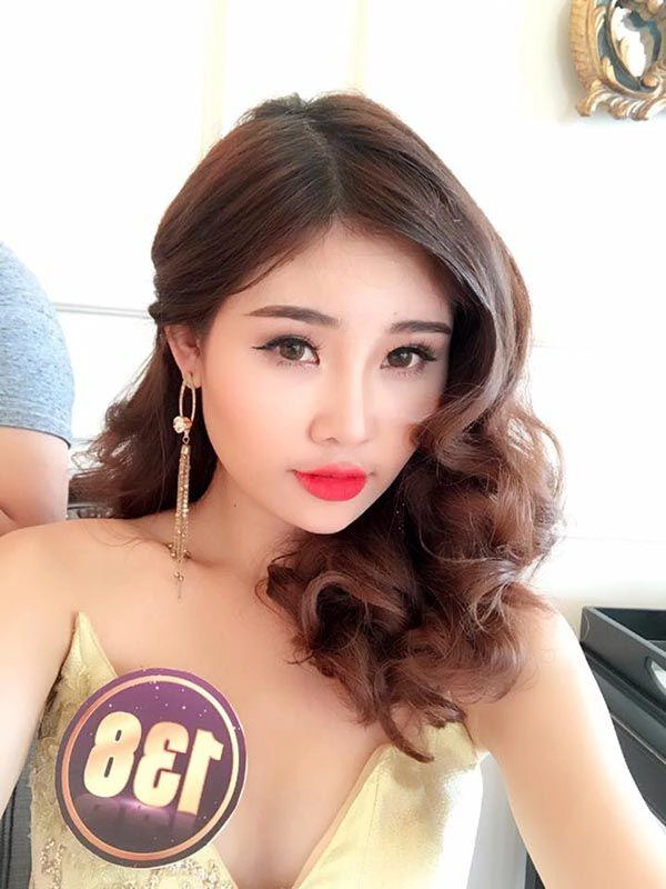 Làng nhan sắc xém nữa đã có 1 vụ kiện giữa hai mỹ nhân chỉ vì chuyện làm răng sứ - 3