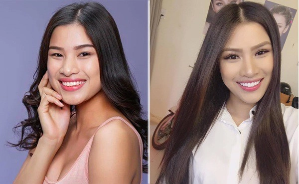 Làng nhan sắc xém nữa đã có 1 vụ kiện giữa hai mỹ nhân chỉ vì chuyện làm răng sứ - 8