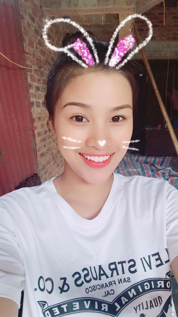 Làng nhan sắc xém nữa đã có 1 vụ kiện giữa hai mỹ nhân chỉ vì chuyện làm răng sứ - 11