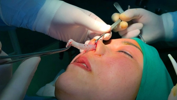 Làng nhan sắc xém nữa đã có 1 vụ kiện giữa hai mỹ nhân chỉ vì chuyện làm răng sứ - 15