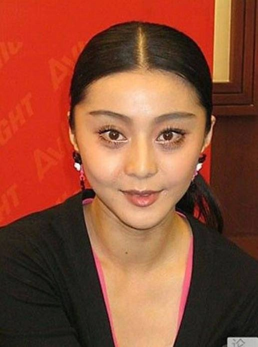 Loạt mỹ nhân bất chấp nguy hiểm bơm chất làm trắng da để vịt hóa thiên nga - 25