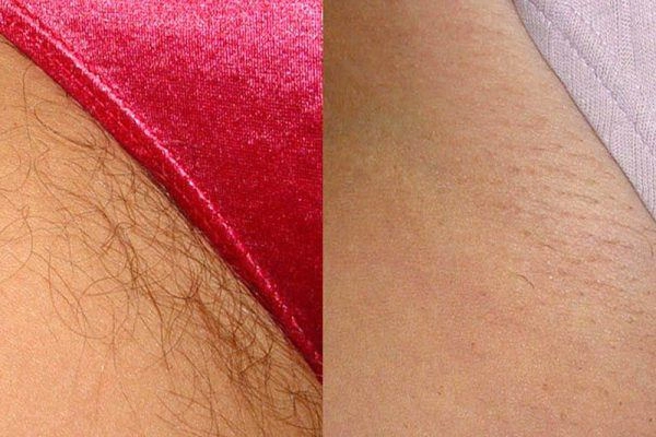 Loạt mỹ nhân vô tư diện bikini siêu mỏng nhờ thực hiện phương pháp dọn dẹp vùng kín - 7