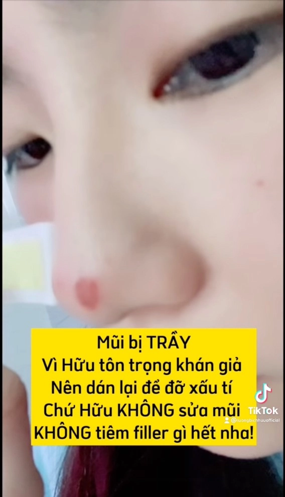 Lương bích hữu bị nói sửa mũi hư nữ ca sĩ tiết lộ nguyên nhân ai cũng nể - 4