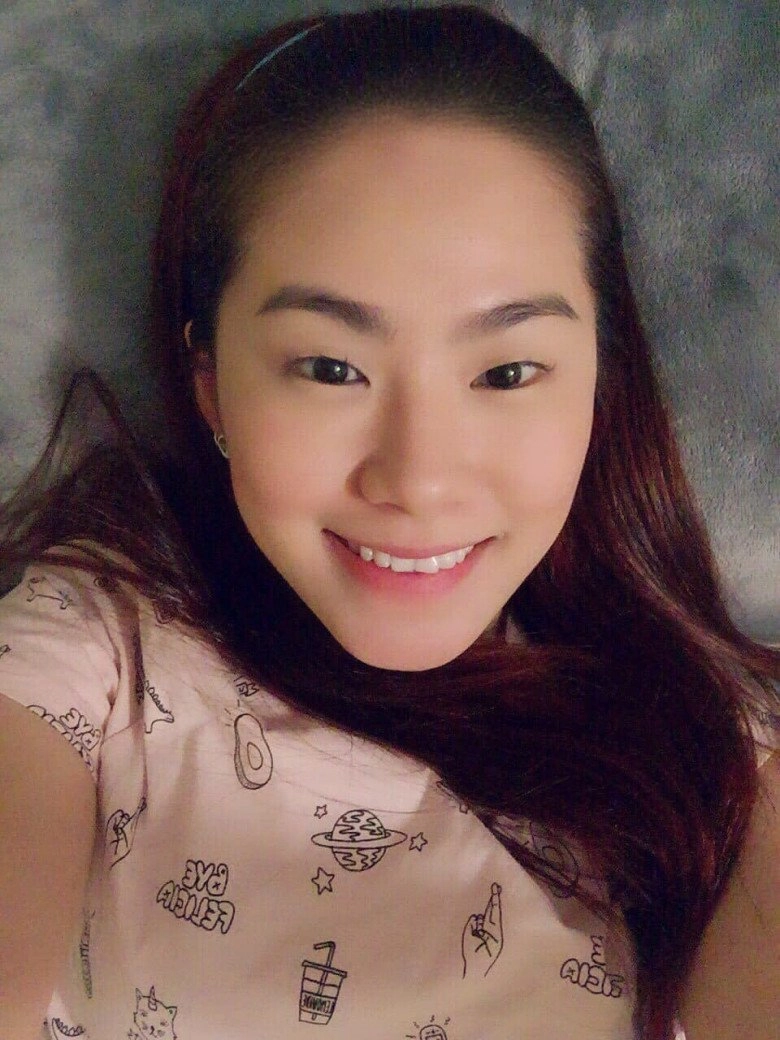 Lương bích hữu bị nói sửa mũi hư nữ ca sĩ tiết lộ nguyên nhân ai cũng nể - 6