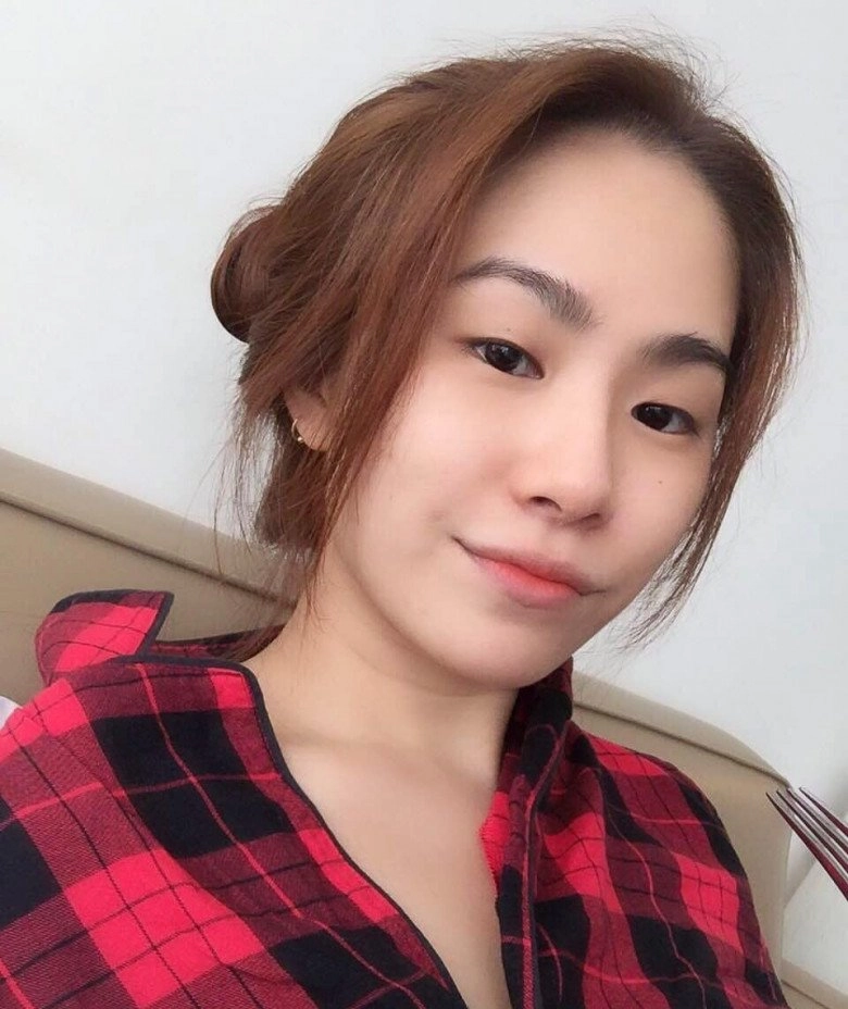 Lương bích hữu bị nói sửa mũi hư nữ ca sĩ tiết lộ nguyên nhân ai cũng nể - 7