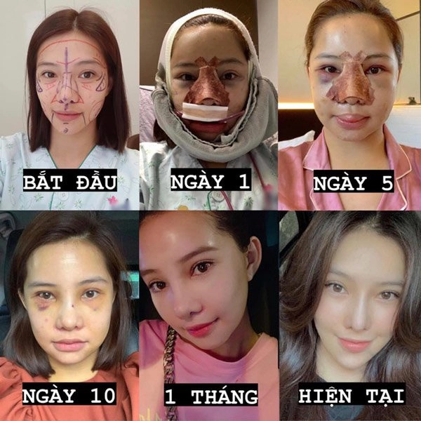 Lưu đê ly đánh đổi vẻ đẹp tự nhiên thành nhân tạo kết quả như thế này đây - 2