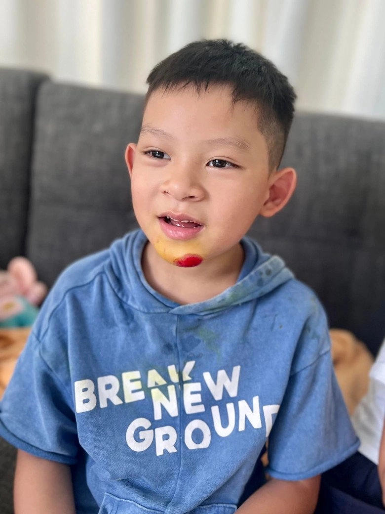 Lý hải minh hà bất lực vì con út 6 tuổi hiếu động chấn thương đầy mình gãy tay gãy xương đòn rách cằm - 4