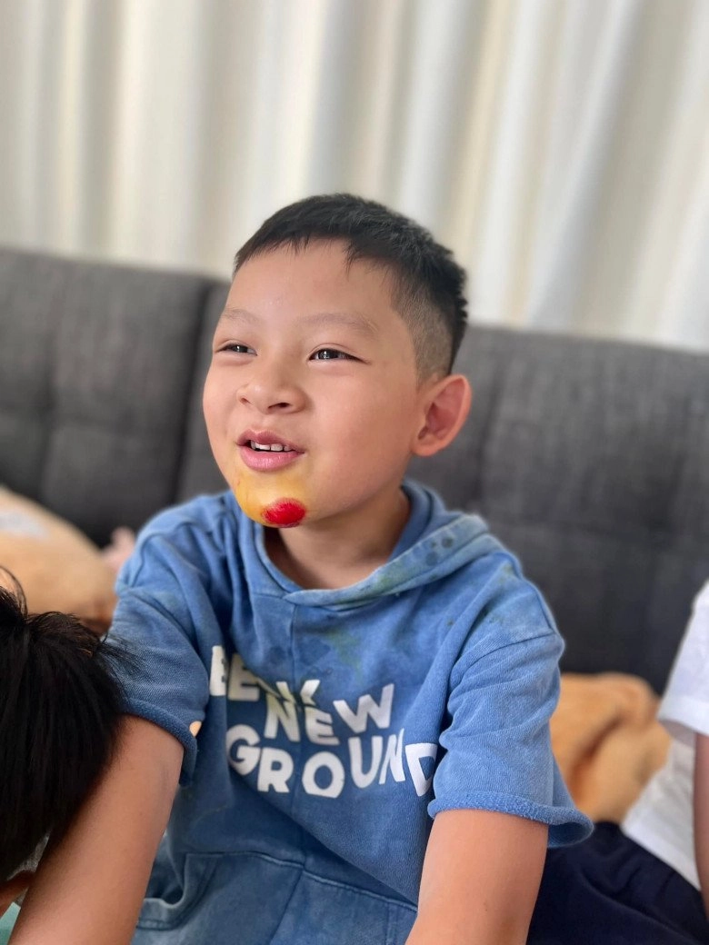 Lý hải minh hà bất lực vì con út 6 tuổi hiếu động chấn thương đầy mình gãy tay gãy xương đòn rách cằm - 5