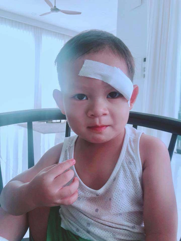 Lý hải minh hà bất lực vì con út 6 tuổi hiếu động chấn thương đầy mình gãy tay gãy xương đòn rách cằm - 6