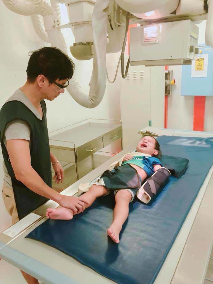 Lý hải minh hà bất lực vì con út 6 tuổi hiếu động chấn thương đầy mình gãy tay gãy xương đòn rách cằm - 7
