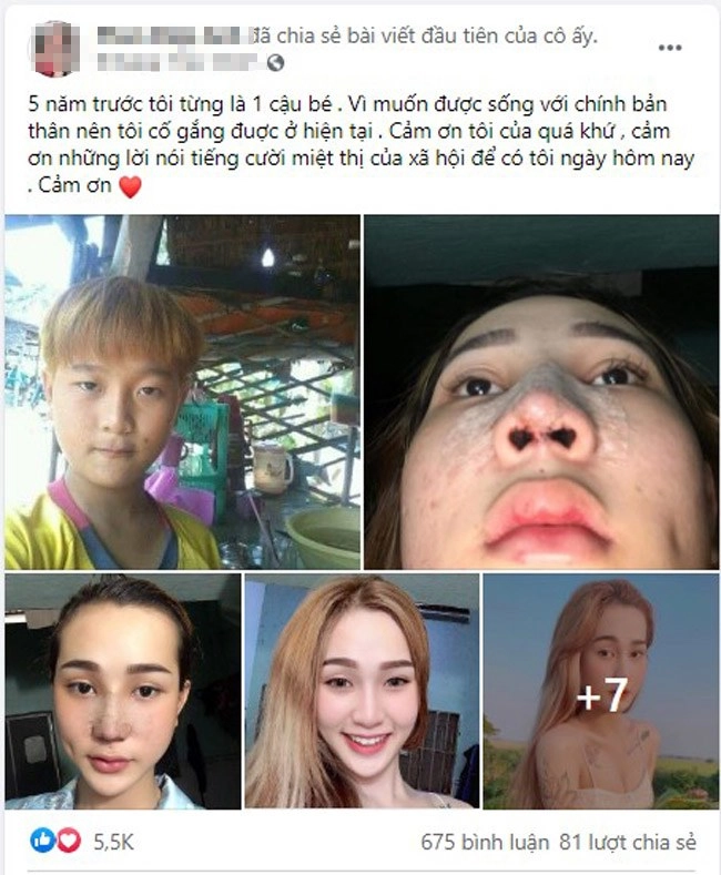 Ly kỳ quá trình chuyển giới từ 1 cậu bé sang mỹ nhân xinh đẹp như hoa hậu - 1
