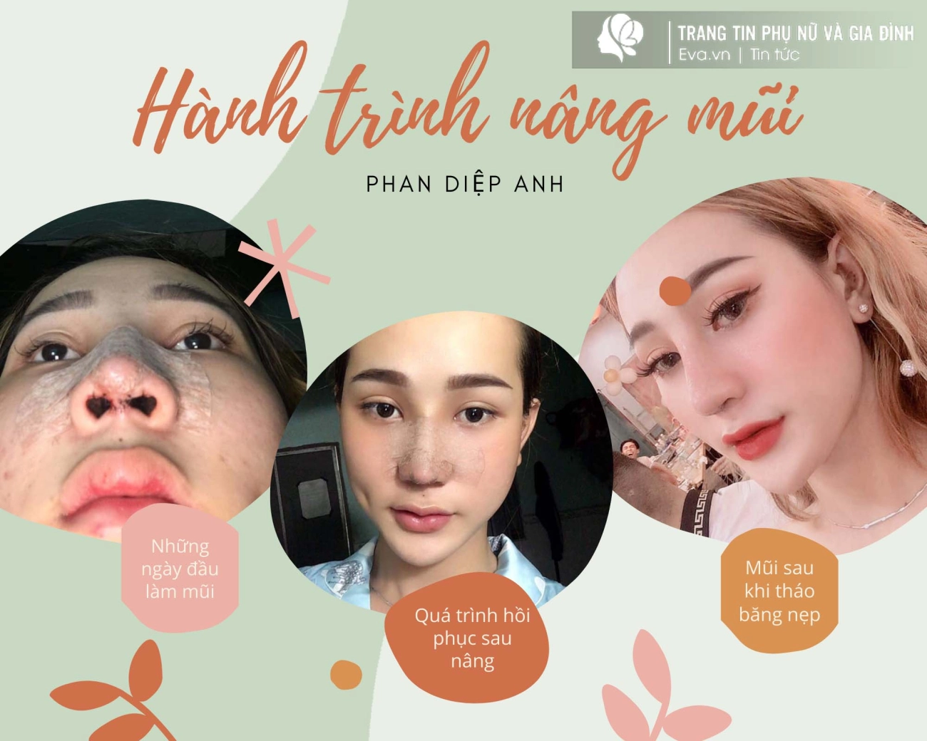 Ly kỳ quá trình chuyển giới từ 1 cậu bé sang mỹ nhân xinh đẹp như hoa hậu - 7