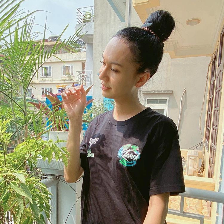 Lynk lee chi 200 triệu đại phẫu cắt gọn da mặt nhưng vẫn không che nổi vầng trán sân bay - 3