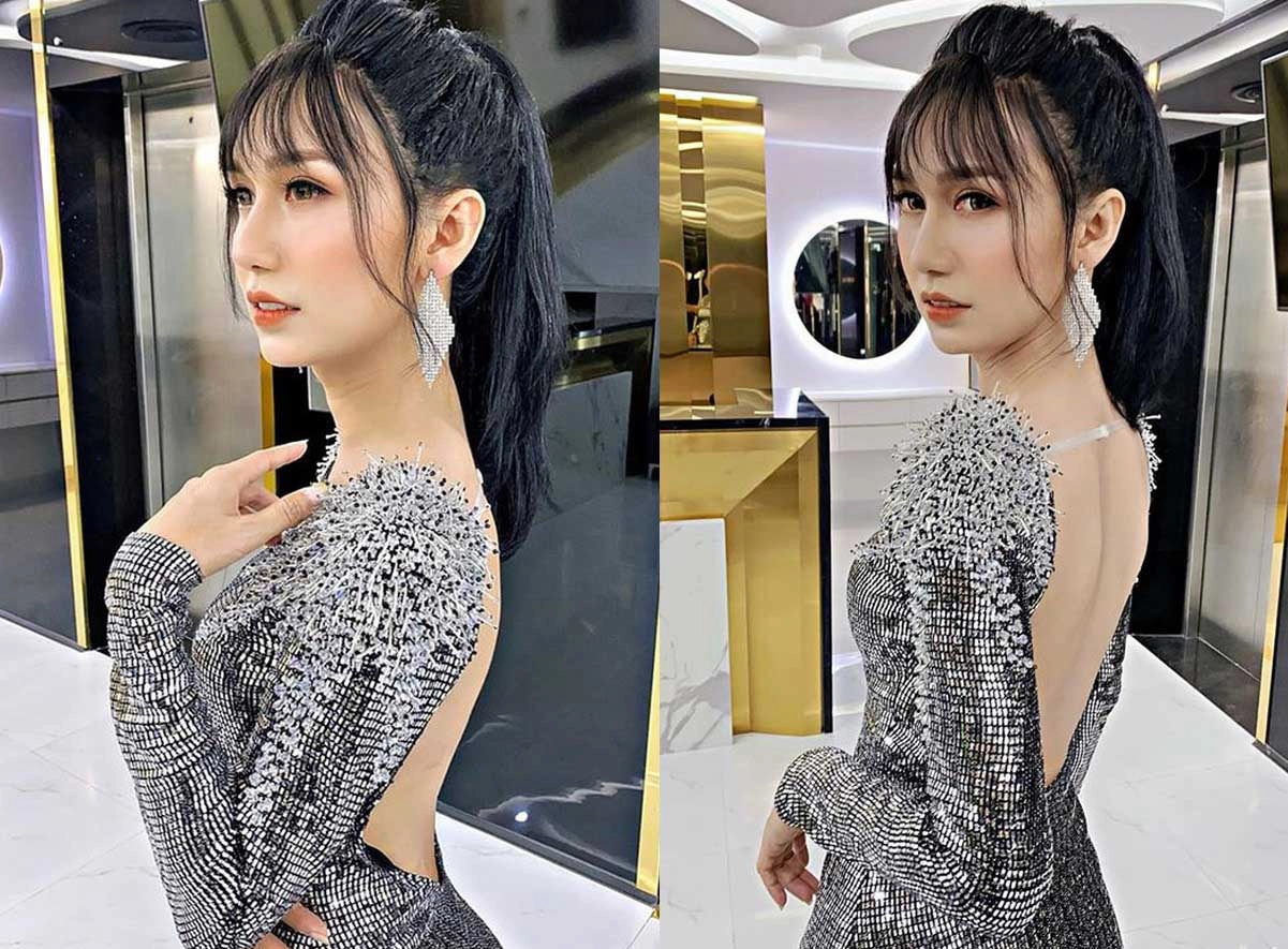 Lynk lee chi 200 triệu đại phẫu cắt gọn da mặt nhưng vẫn không che nổi vầng trán sân bay - 6