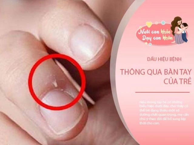 Mắc sai lầm này khi tắm cho bé sơ sinh mẹ vô tình rước bệnh cho con - 7