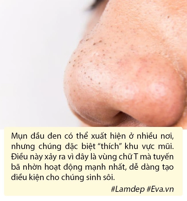 Máy hút mụn đầu đen lợi hại thật nhưng đây có phải cách trị mụn bạn nên dùng - 2