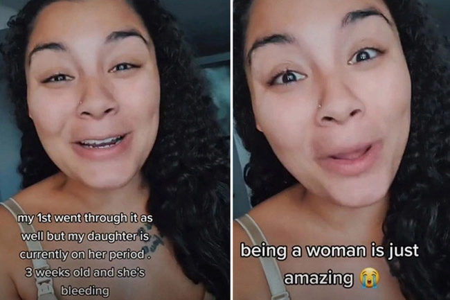 Mẹ bỉm sữa lo lắng khi con 3 tuần tuổi đã rụng dâu đỏ hết cả bỉm - 1