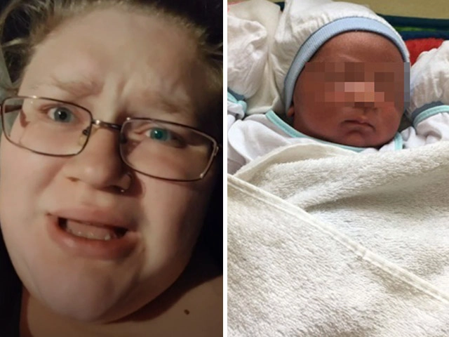 Mẹ bỉm sữa lo lắng khi con 3 tuần tuổi đã rụng dâu đỏ hết cả bỉm - 3