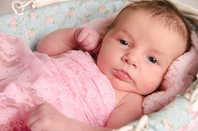 Mẹ bỉm sữa lo lắng khi con 3 tuần tuổi đã rụng dâu đỏ hết cả bỉm - 4