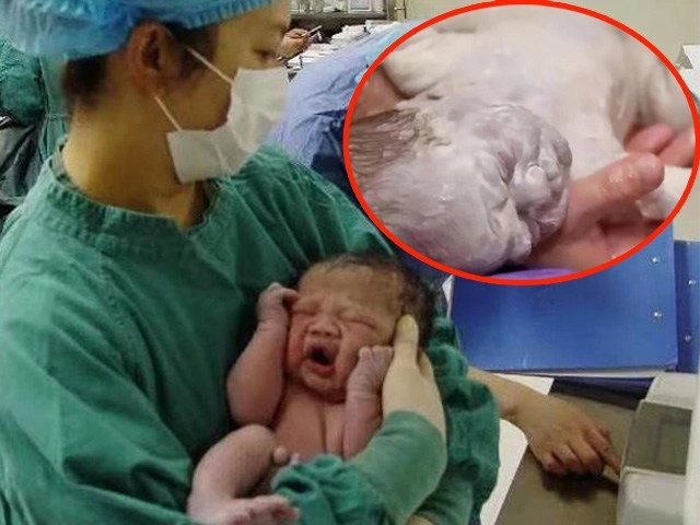 Mẹ bỉm sữa lo lắng khi con 3 tuần tuổi đã rụng dâu đỏ hết cả bỉm - 5