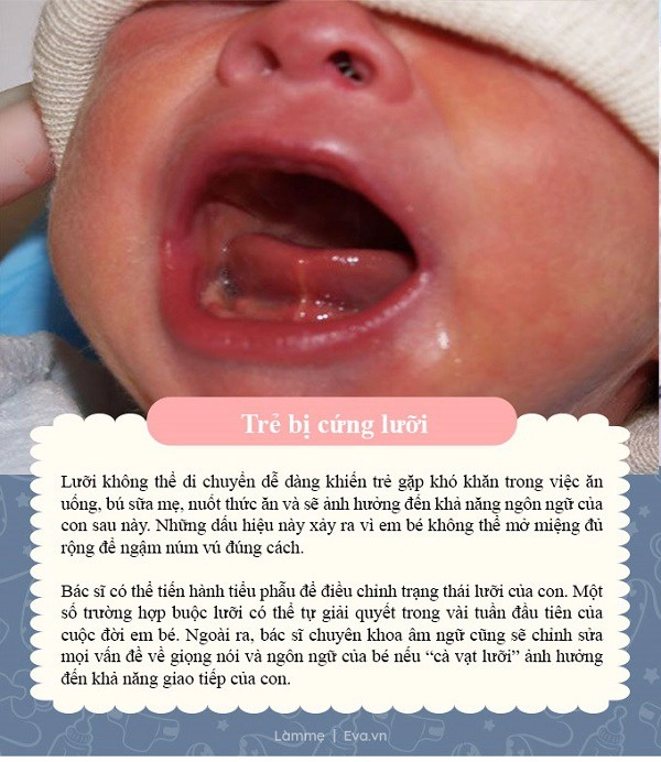 Mẹ chăm con rất kỹ mà bé vẫn không tăng cân có thể là vì 8 nguyên nhân sau - 6