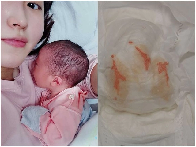 Mẹ phát hiện ngấn 2 bên chân con không đối xứng bs kết luận chữa nhanh còn kịp - 5
