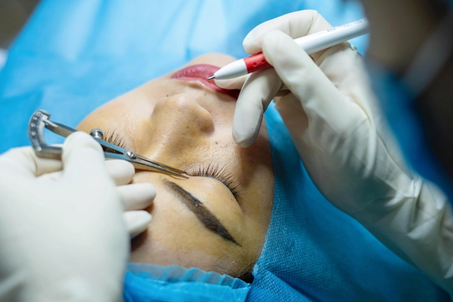 Mở góc mắt là gì mà được nhiều chị em quan tâm - 2