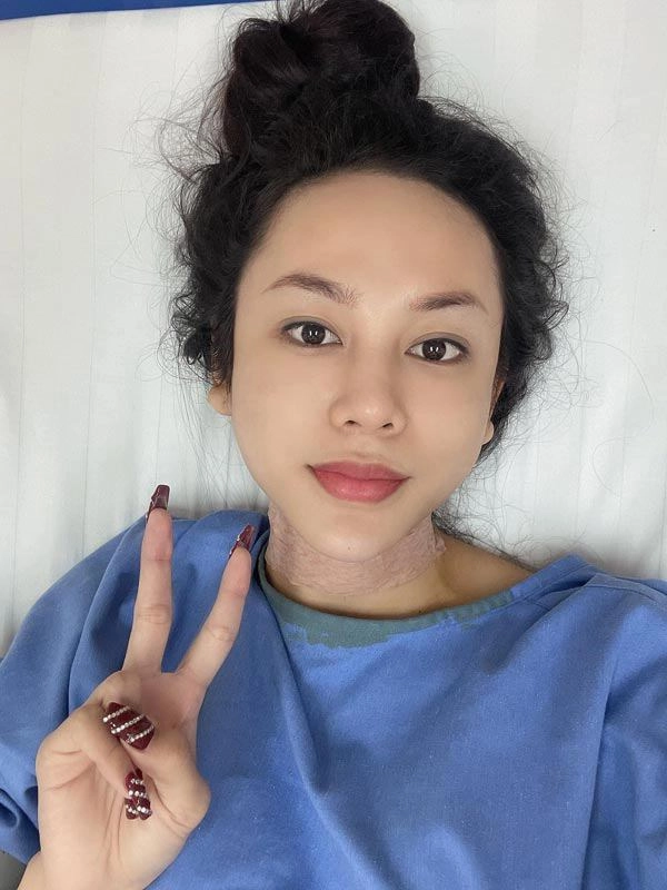 Một người đẹp vbiz bất ngờ cắt trái cổ hoàn thiện vẻ đẹp thục nữ hiếm có - 1
