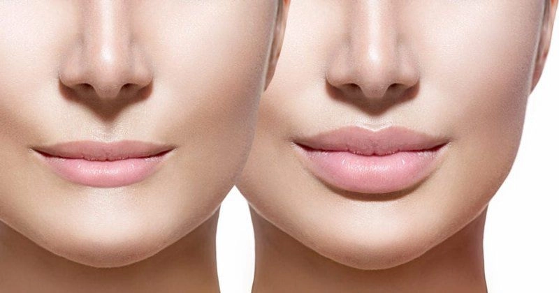 Một thời là mỹ nhân bốc lửa maria đinh phương ánh giờ đây mặt cứng đờ như tượng sáp - 14