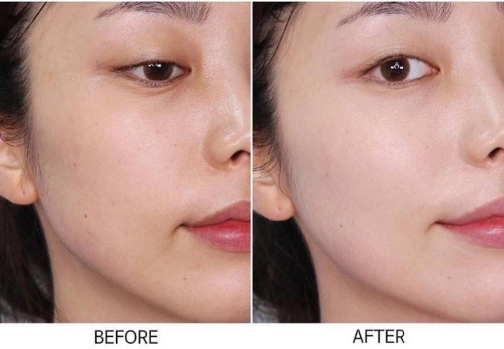 Mùa hè mặt như chảo dầu chiên cá nàng nhất định phải để ý những thành phần này trong serum - 6