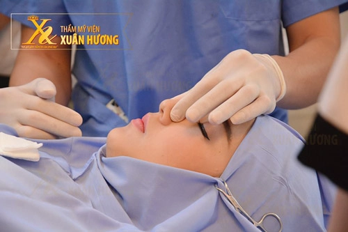 Mũi cao có phải là mũi đẹp - 1