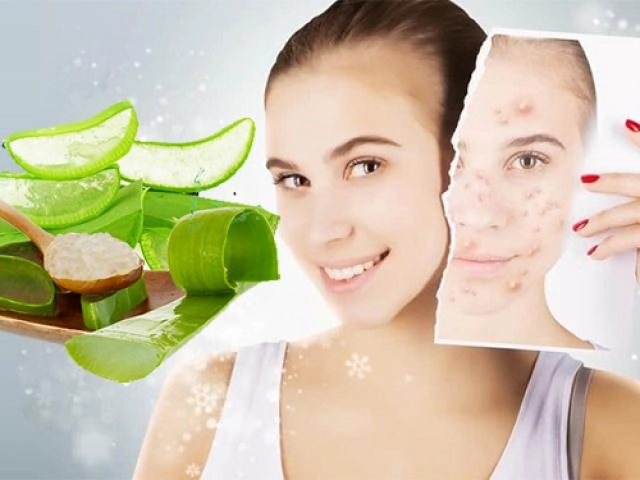Mụn trứng cá xuất hiện do đâu và cách điều trị hiệu quả - 20