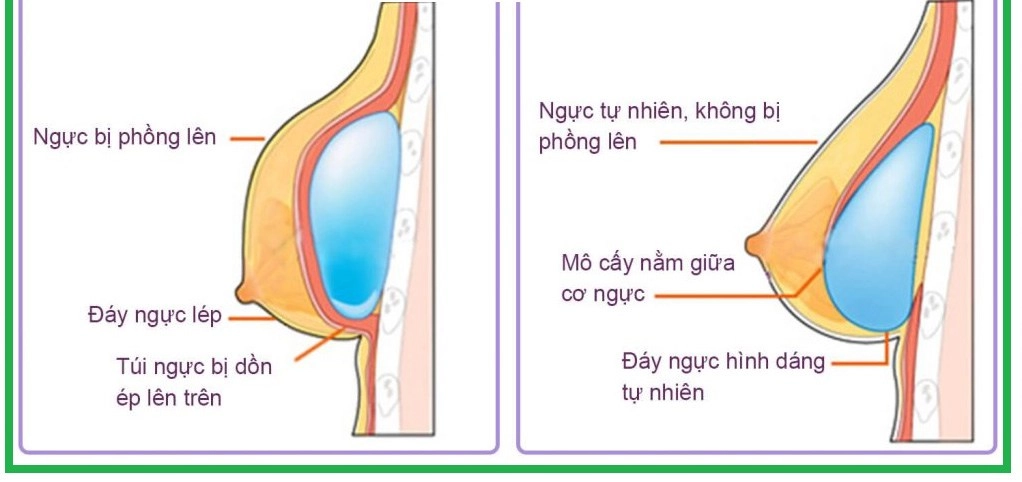 Mỹ nhân quyến rũ nhất về nhà đi conkhoe dáng với bikini vòng 1 dao kéo nổi bật - 7