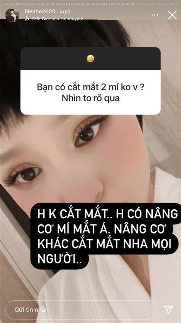 Mỹ nhân việt làm đẹp không phẫu thuật với filler nắn xương chị em có thể tham khảo - 6