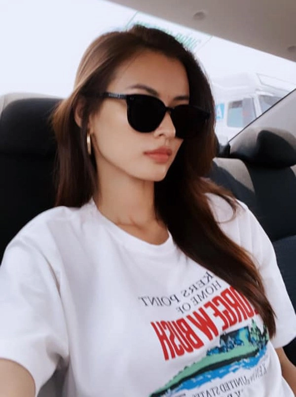 Mỹ nhân việt làm đẹp không phẫu thuật với filler nắn xương chị em có thể tham khảo - 10