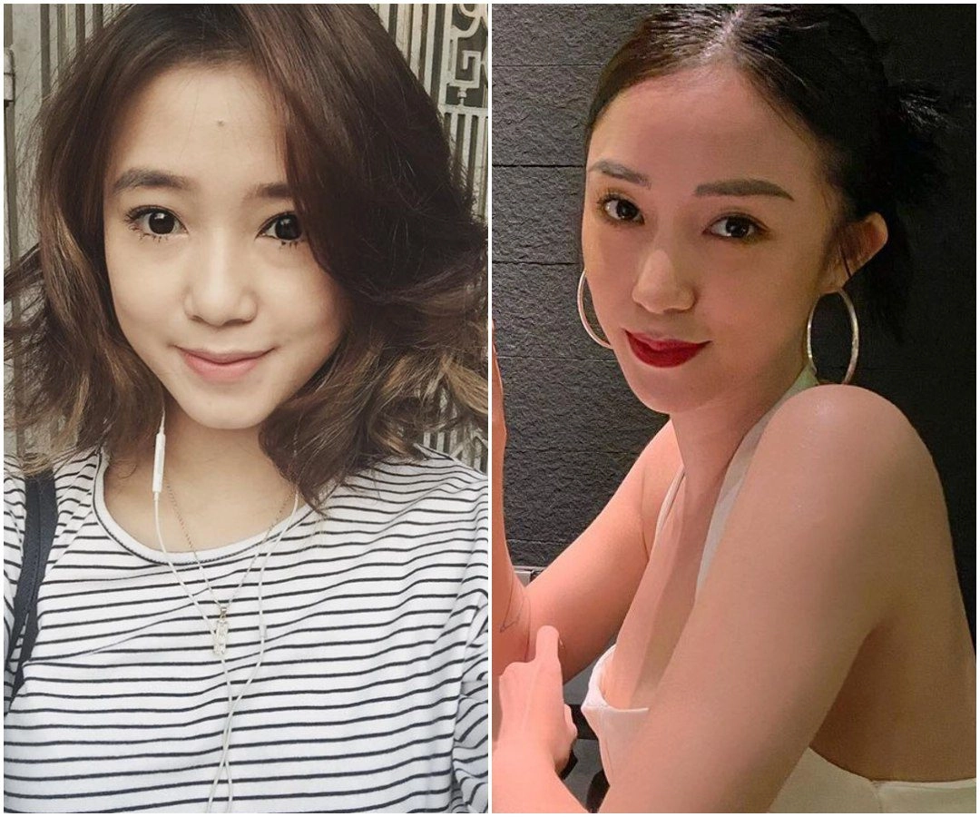 Mỹ nhân việt vướng thị phi dao kéo chỉ vì sửa 1 bộ phận chẳng liên quan - 2