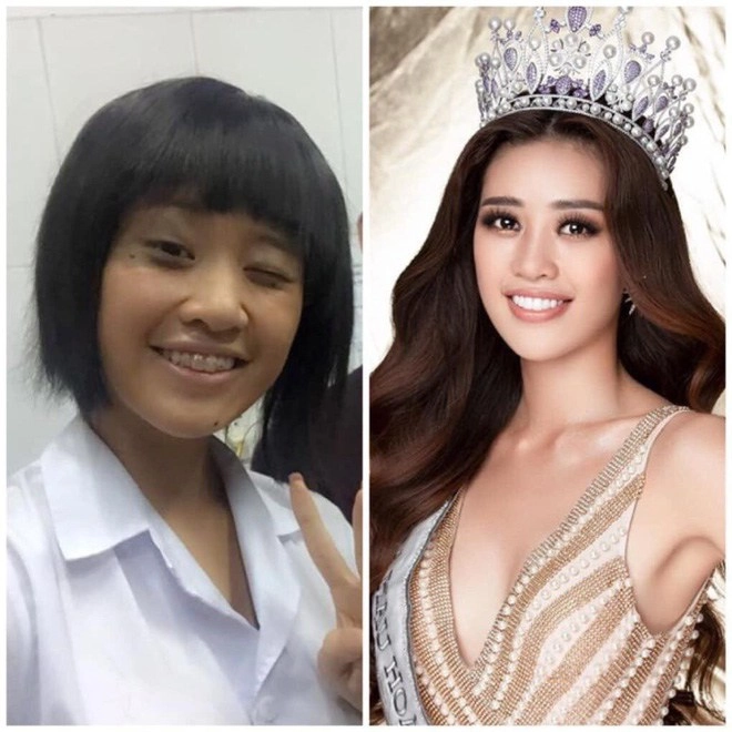 Mỹ nhân việt vướng thị phi dao kéo chỉ vì sửa 1 bộ phận chẳng liên quan - 8