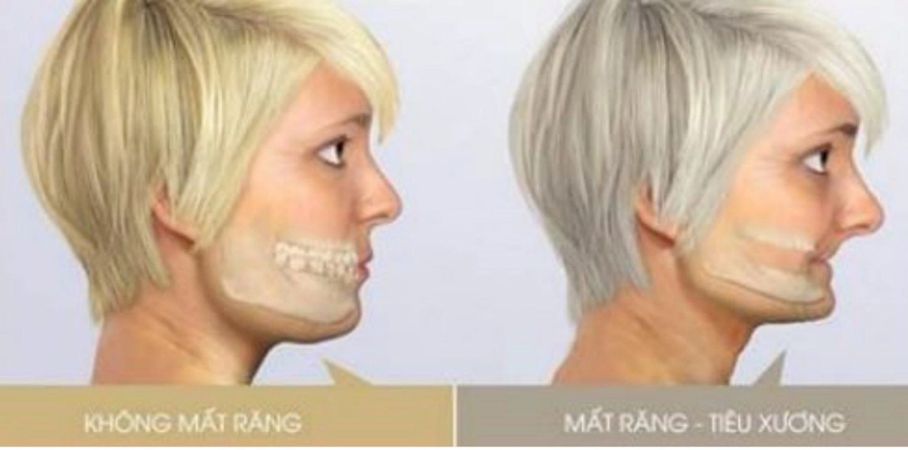 Mỹ nhân việt vướng thị phi dao kéo chỉ vì sửa 1 bộ phận chẳng liên quan - 9