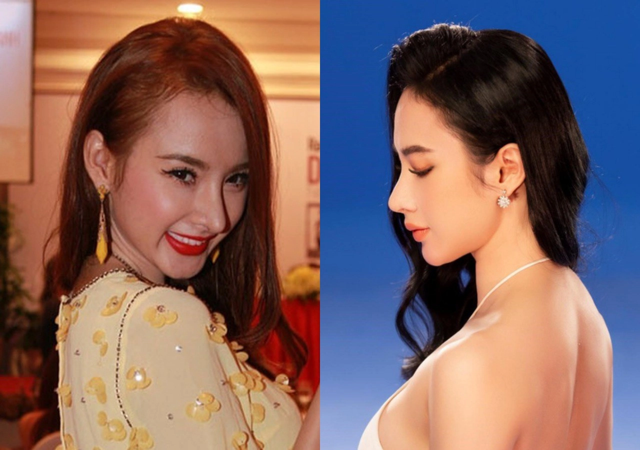 Nâng mũi như cuộc chạy đua với thời trang làm đủ kiểu cuối cùng vẫn quay về 1 dáng - 6