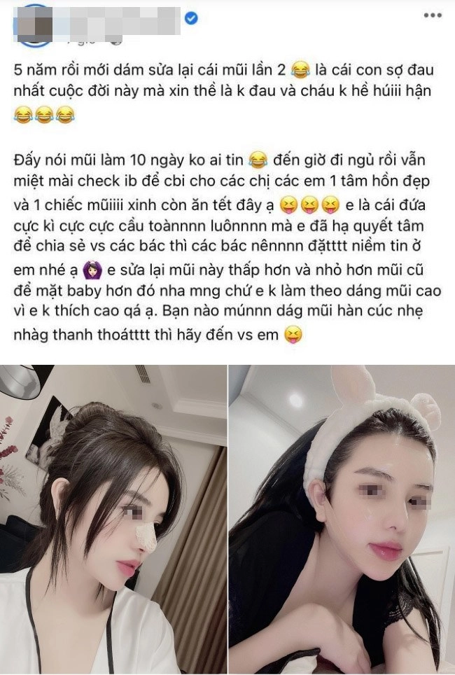 Nâng mũi như cuộc chạy đua với thời trang làm đủ kiểu cuối cùng vẫn quay về 1 dáng - 7