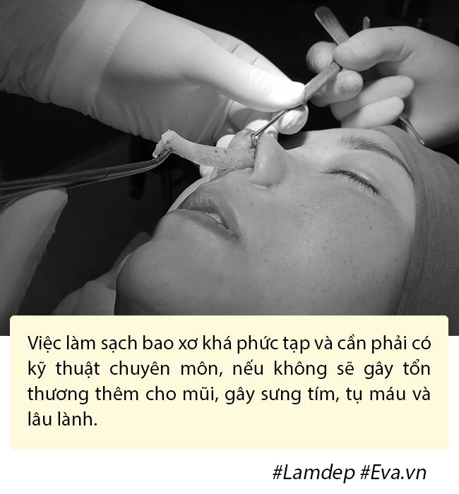 Nâng mũi như cuộc chạy đua với thời trang làm đủ kiểu cuối cùng vẫn quay về 1 dáng - 8