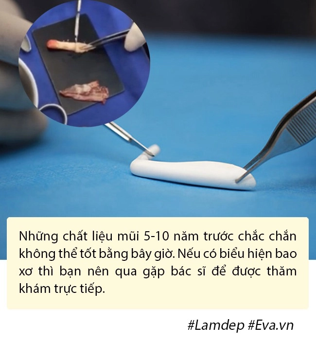 Nâng mũi như cuộc chạy đua với thời trang làm đủ kiểu cuối cùng vẫn quay về 1 dáng - 11