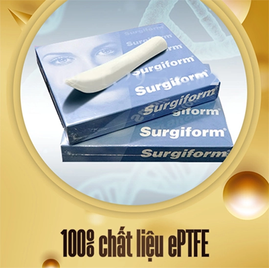 Nâng mũi sụn surgiform - xu hướng làm đẹp năm 2022 - 1