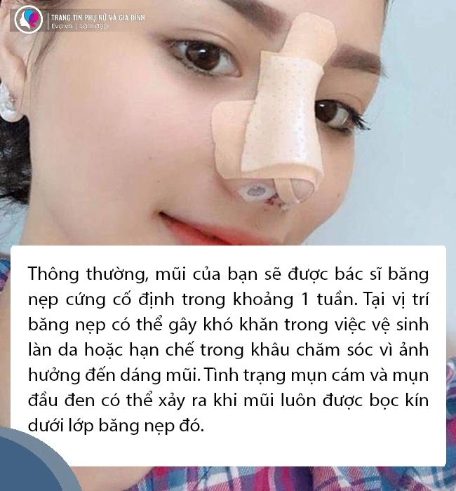 Nâng mũi xong về mụn nổi ầm ầm chị em bình tĩnh đọc kĩ bài viết này - 6
